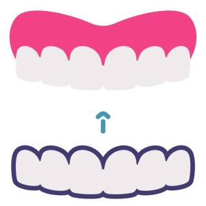 Invisalign